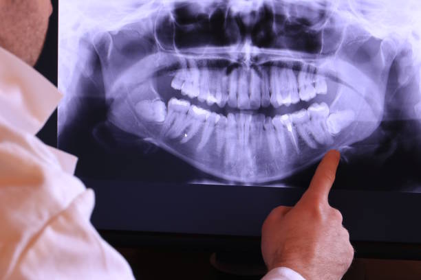 Best Emergency Treatment for Dental Infections or Abscesses in Rockville Centre, NY